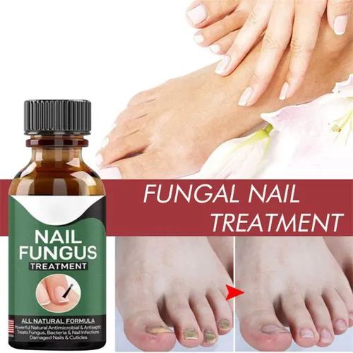 Nail Fungus Ka Khatma – Repair Serum Gel 30ml